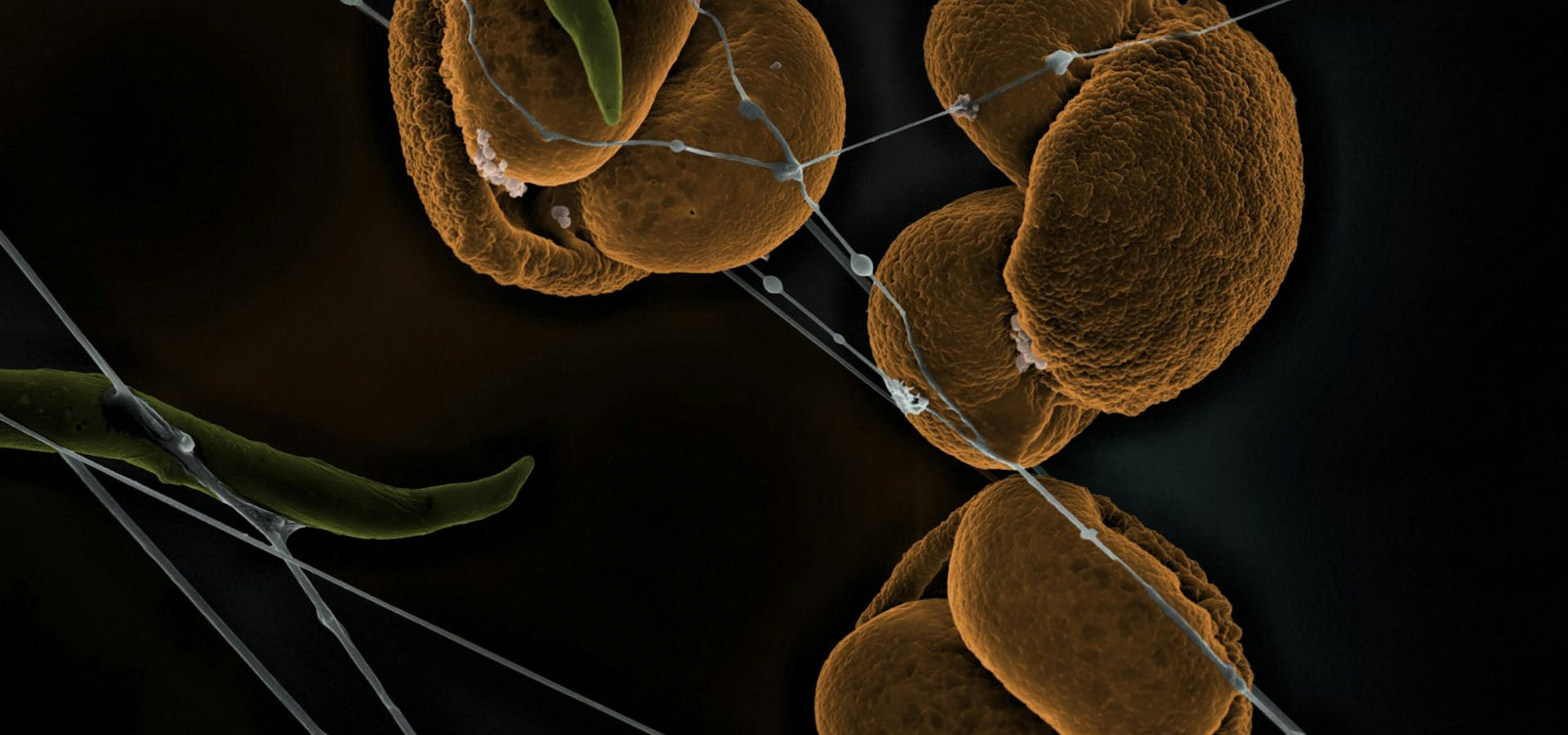 Microscopic view of round, brown spores connected by fine blue filaments against a dark background, with some green structures also visible