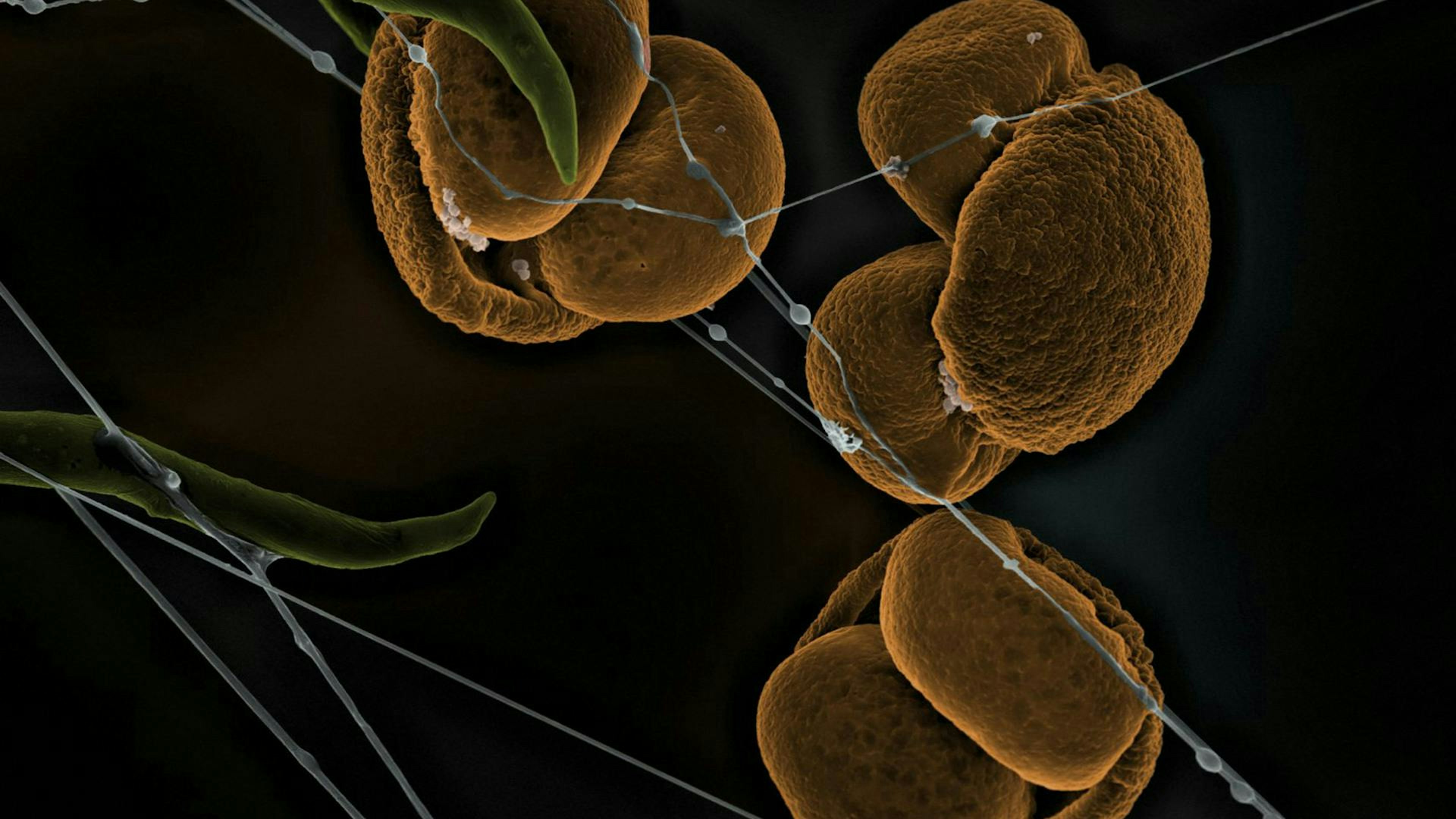 Microscopic view of round, brown spores connected by fine blue filaments against a dark background, with some green structures also visible